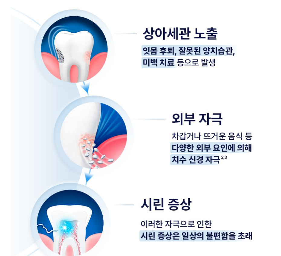 센소다인 멀티케어 치약, 100g, 3개 상품 소개 4 치아 증상